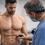 Em pacientes que treinam intensamente, a musculatura influencia diretamente o planejamento da cirurgia plástica, destaca Haeckel Cabral Moraes.