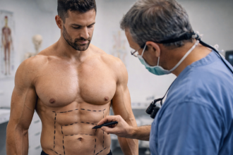 Em pacientes que treinam intensamente, a musculatura influencia diretamente o planejamento da cirurgia plástica, destaca Haeckel Cabral Moraes.